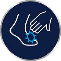 Kožné plesne sa ľahko šíria kontaktom koža na kožu - takže ak sa dotknete miesta infikovaného atletickou nohou a potom sa dotknete svojho tela, môže to viesť k infekcii svrbenia slabín.